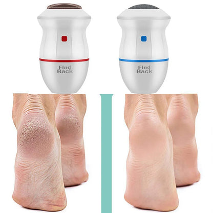 FIND BACK CALLUS REMOVER – GET SMOOTH, SOFT FEET IN SECONDS!